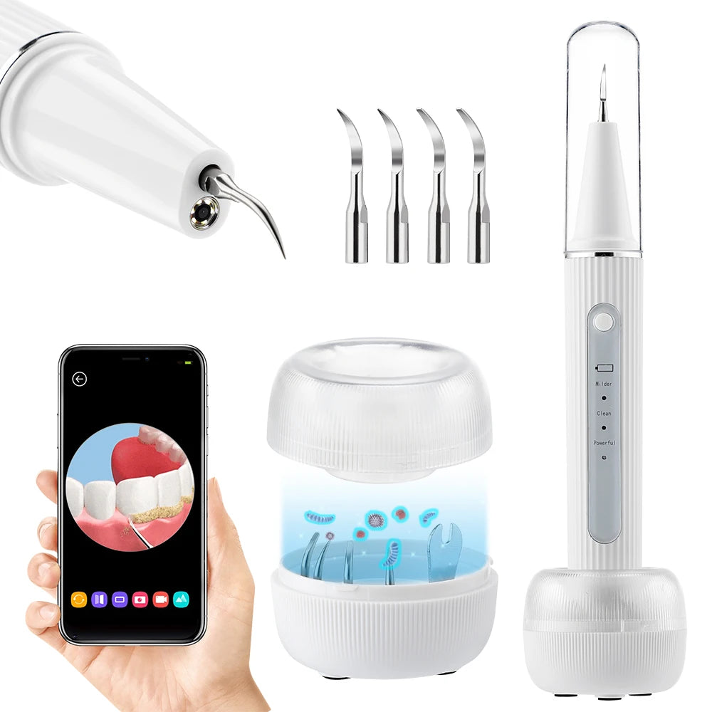 SparkleScan – Ultraschall-Zahnreiniger und Zahnsteinentferner 2