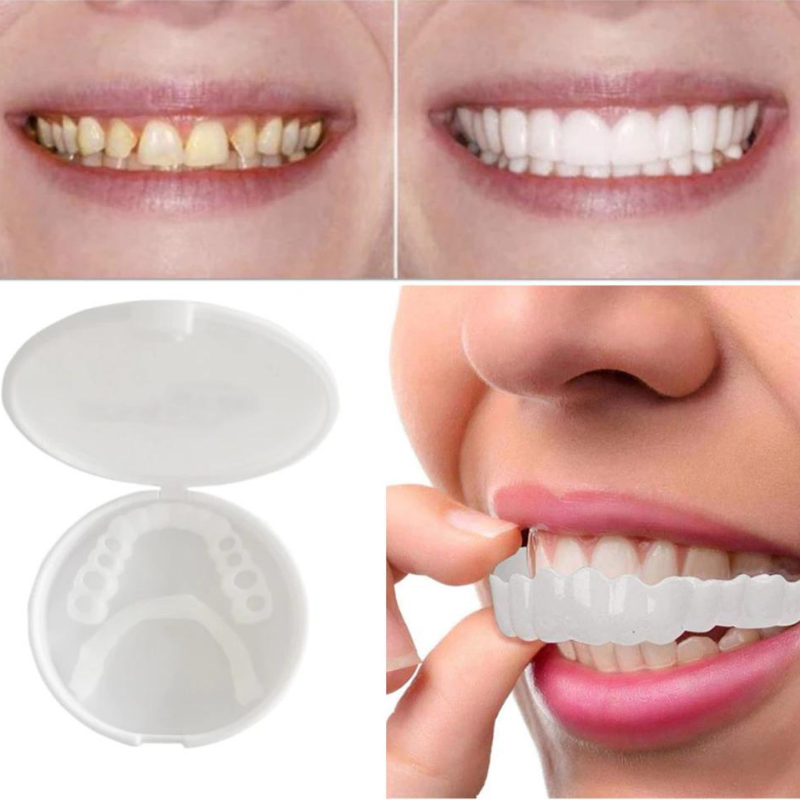 HelleBiss EasyClick – Easy to apply dental prosthesis